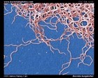 Borrelia burgdorferi microscopy image